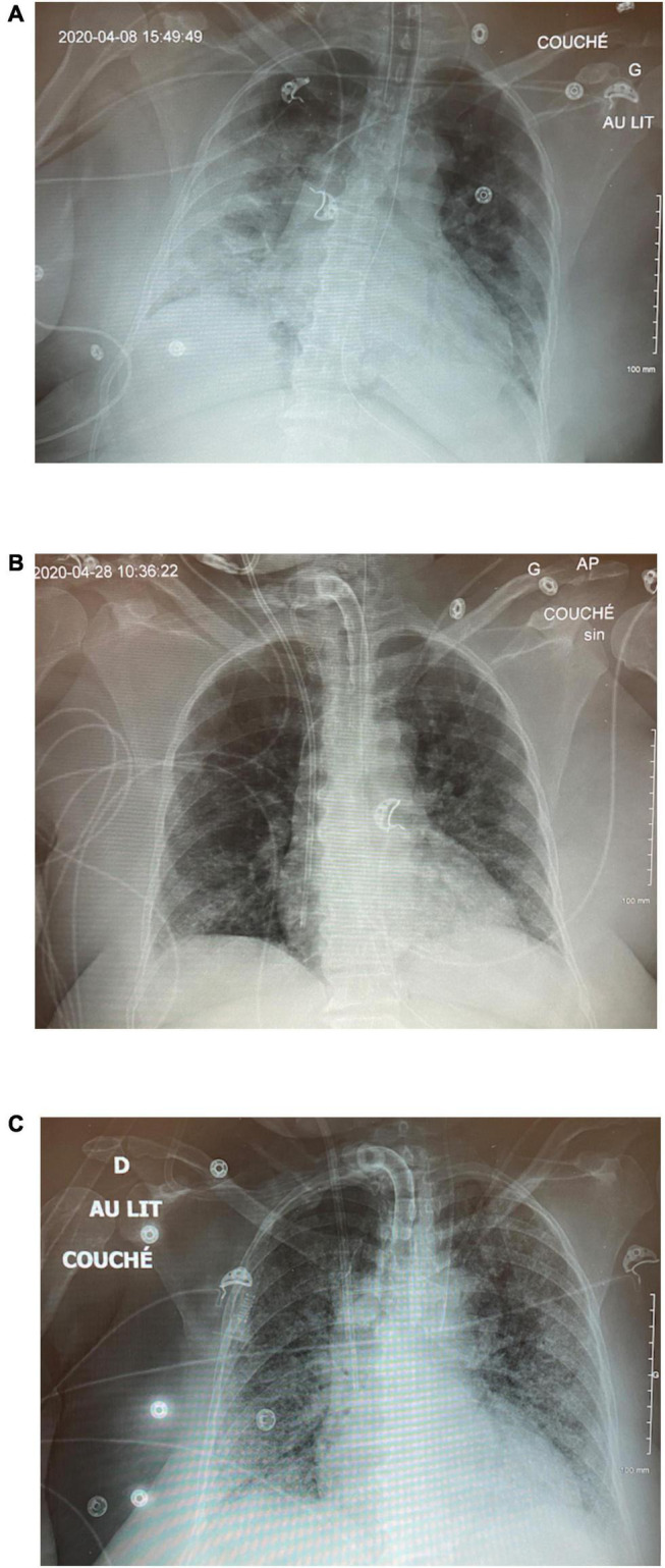 FIGURE 3