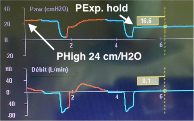 FIGURE 2