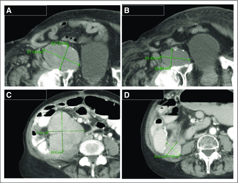 Fig 3.