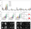 Figure 3. Biodistribution of the [225Ac]DOTA-YS5 in 22Rv1 xenograft-bearing mice confirming high delivery of the [225Ac]DOTA-YS5 to tumor tissue. A, The distribution of [225Ac]DOTA-YS5 (represented as %ID/g, mean ± SD, n = 4) in organs collected from day 1 to day 17. B, Tumor to blood, tumor to muscle, and tumor to kidney ratios from the biodistribution studies indicate [225Ac]DOTA-YS5 clearance with simultaneous accumulation in tumor tissue. C, Gamma energy spectra showing accumulation of 213Bi in kidneys. As compared with the equilibrium gamma energy spectra of [225Ac]DOTA-YS5, increased intensity of the 213Bi was observed in kidney samples at 24 hours. D, iQID camera digital autoradiographic imaging for distribution of the [225Ac]DOTA-YS5 in 22Rv1 xenograft tumor and healthy tissues studied from day 1 to day 7 after injections. The distribution of the radioactivity in tumor tissue is heterogenous, whereas all the other organs show homogenous distribution.