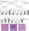 Figure 5. Chronic toxicity study of the [225Ac]DOTA-YS5 in nude mice (n = 4). A, The body weight measurements of the mice injected with the [225Ac]DOTA-YS5 show a gradual decrease with 0.5 μCi administration, whereas no significant body weight loss was seen in the 0.25 μCi dose or in the saline control group. B, Survival plot in the toxicity study. C, Liver and kidney function tests results showing increase in creatinine, blood urea nitrogen, and alkaline phosphatase. D, Blood cell counts confirming no significant difference in saline control versus [225Ac]DOTA-YS5–injected mice. E, Histologic H&E findings in the kidney of a mouse injected with 0.5 μCi activity level with diffuse parenchymal damage and occlusion of glomerular capillary loops by fibrin thrombi with glomerulosclerosis. F, Trichrome stain highlighting fibrin thrombi. G, Higher power images showing tubular injury in the mouse treated with [225Ac]DOTA-YS5. One-way ANOVA P values are indicated as *, P < 0.05; **, P < 0.01; ***, P < 0.001.