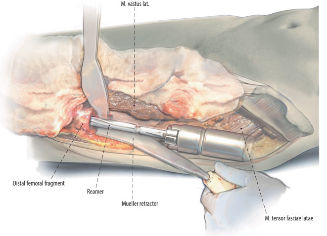 Fig. 9