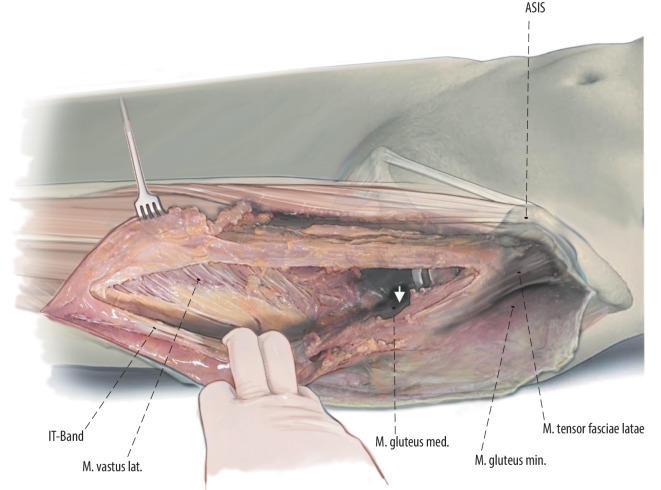 Fig. 3