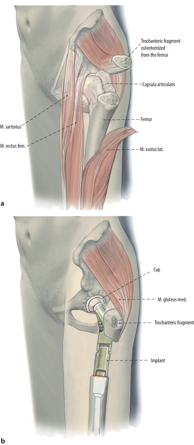 Fig. 13