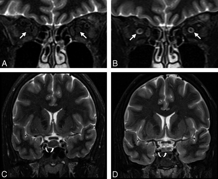 Fig 3.