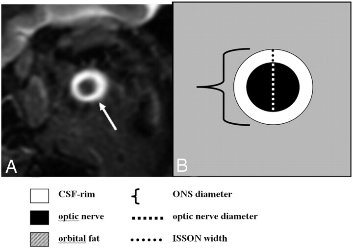 Fig 1.