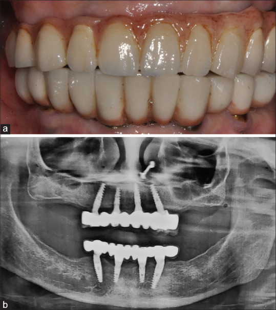 Figure 13