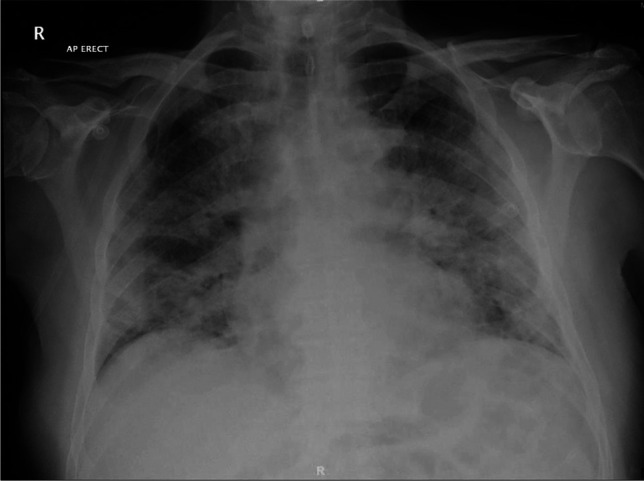 Fig 1.