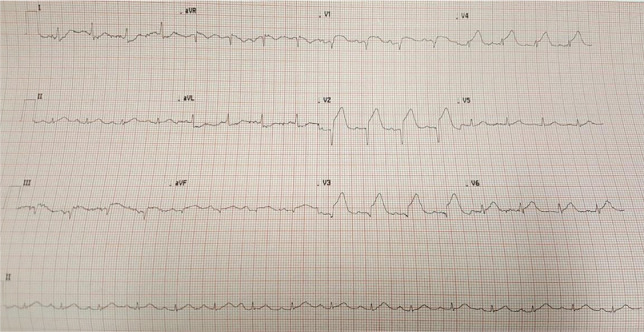 Fig 2.