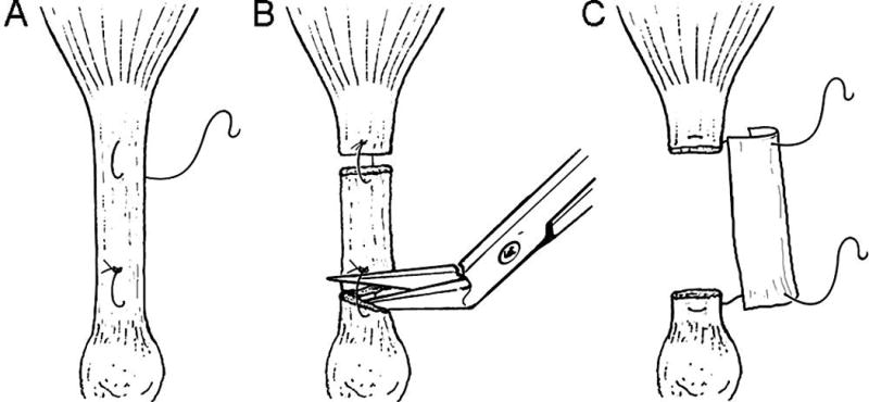 FIG. 1