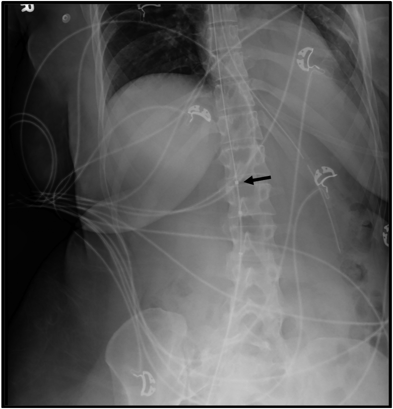 Fig. 1B