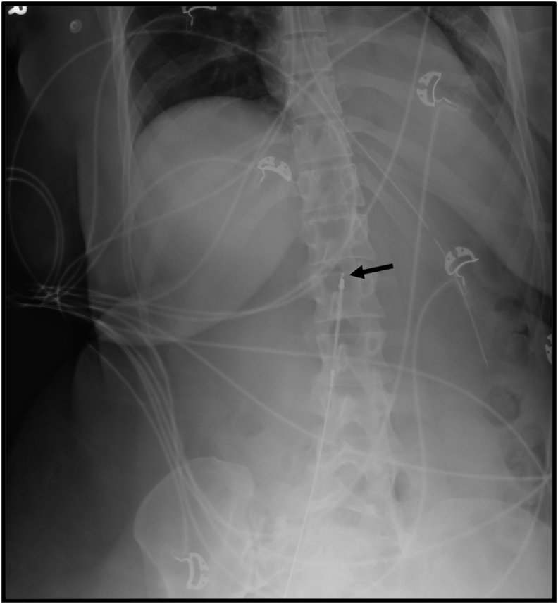 Fig. 1C