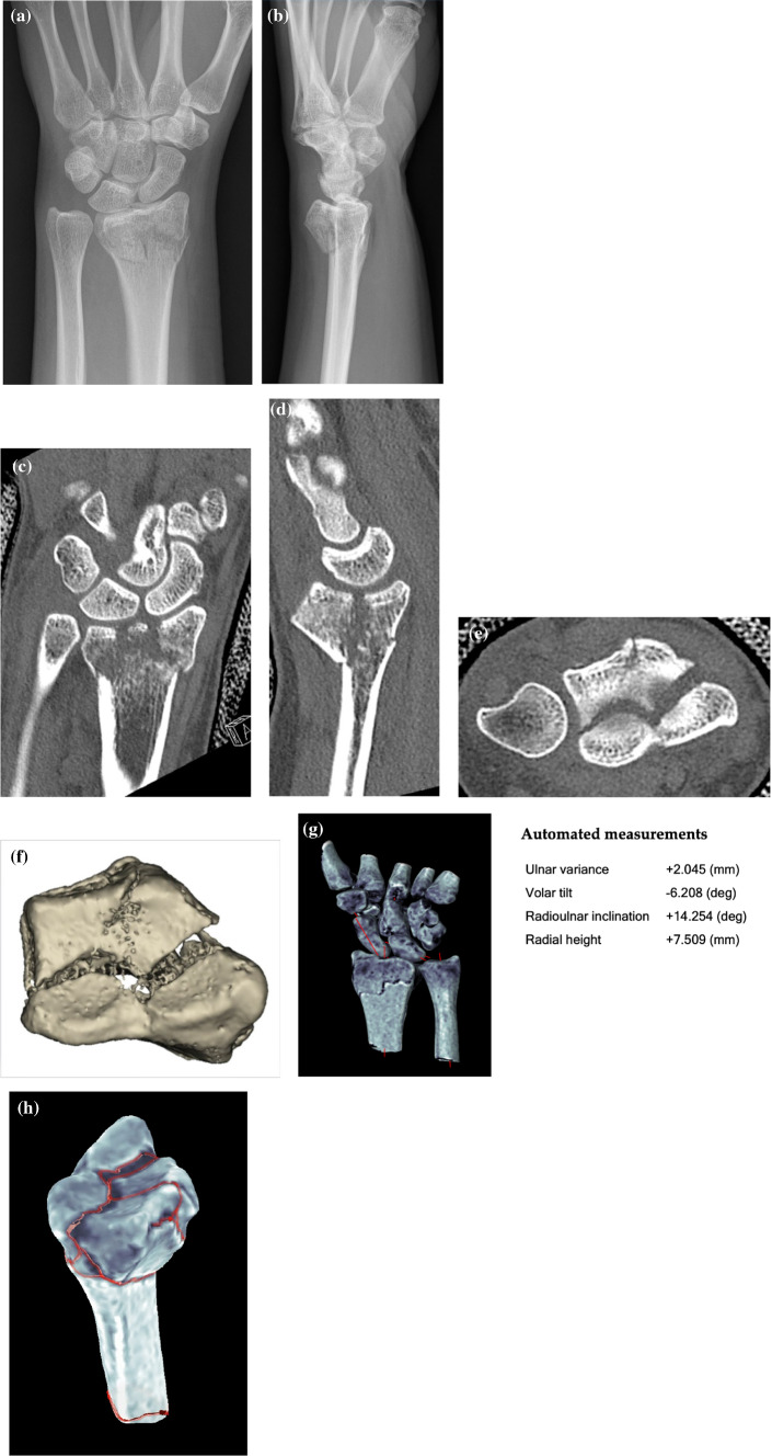 Fig. 2