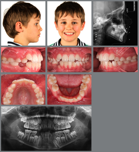 Figure 22: