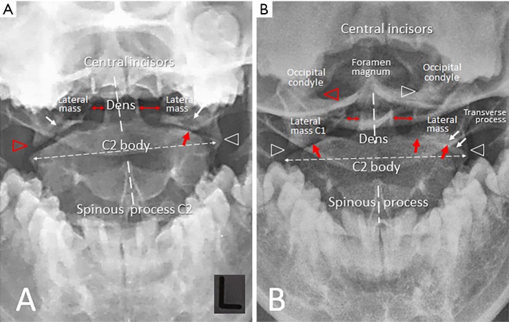 Figure 2