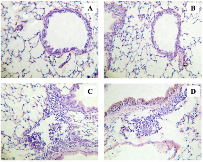 Fig. (1)