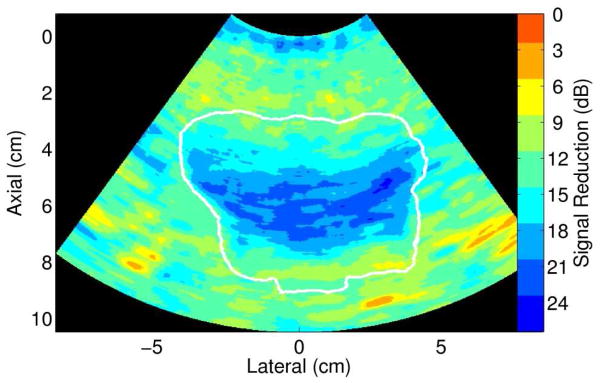 FIG. 10