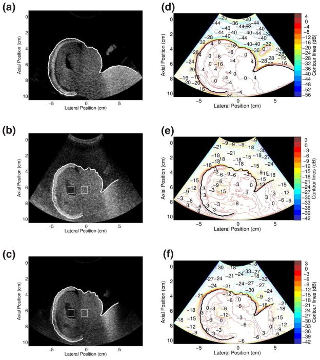 FIG. 5