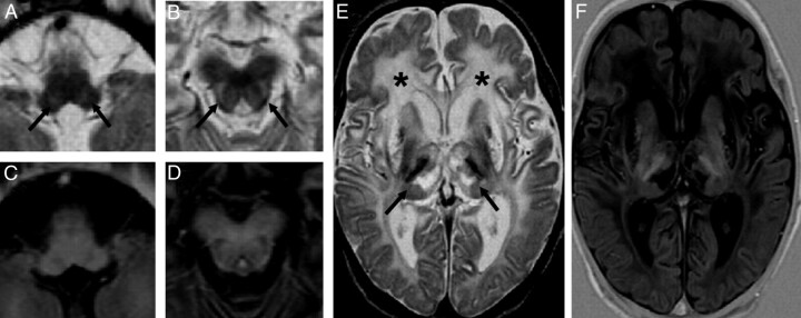 Fig 3.