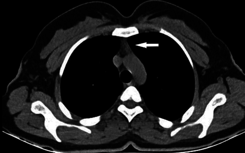 FIGURE 3