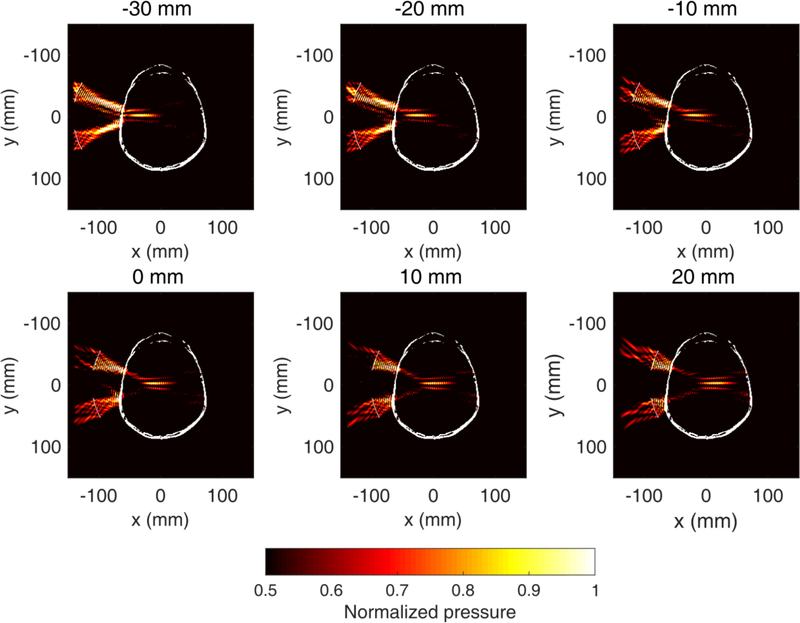 Fig. 3 :