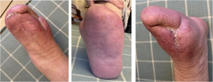 Fig. 3