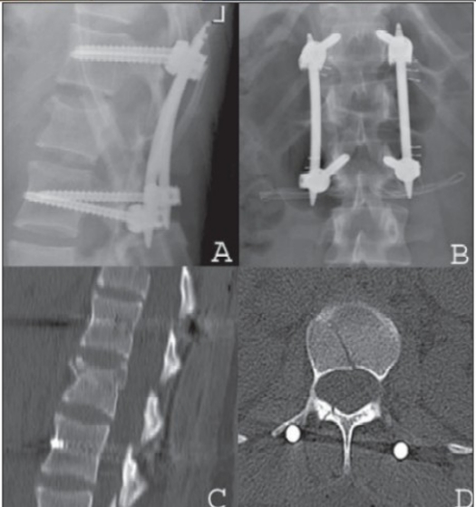 Figure 3.3