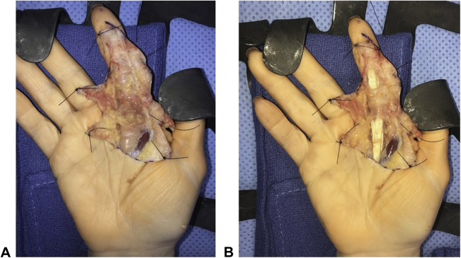 Figure 3