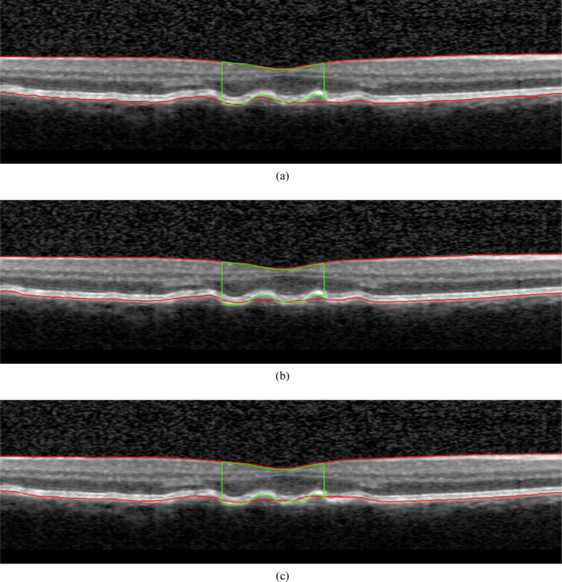 Fig. 10