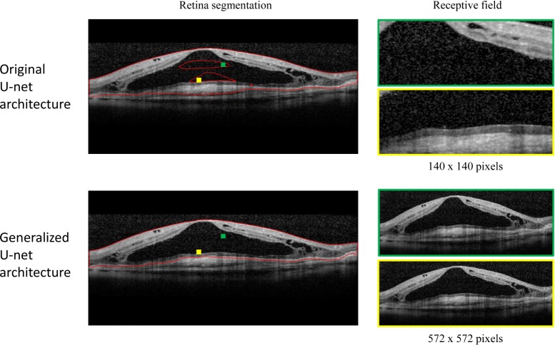 Fig. 17