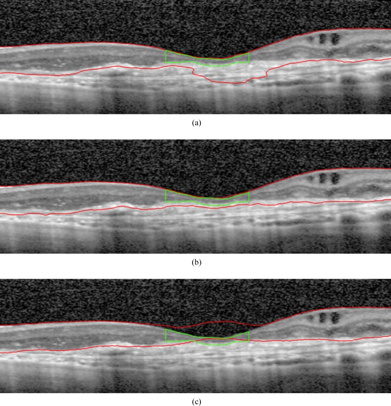 Fig. 11