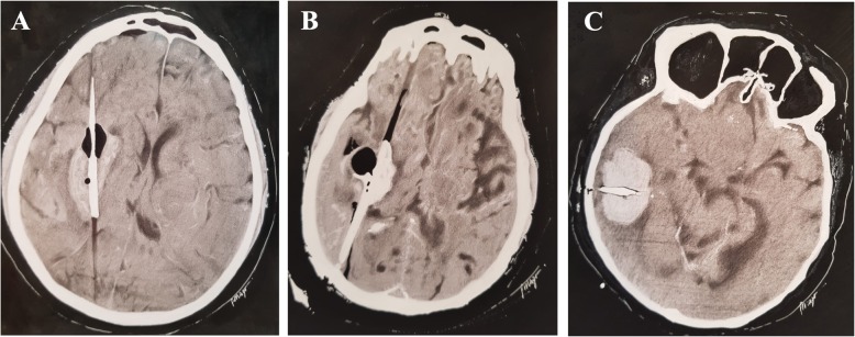 Fig. 5