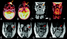 Fig 4.