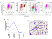 Figure 4. Analysis of abnormal dendritic cell proportions before and after treatment. (A) Flow cytometry analysis of abnormal plasmacytoid dendritic cells (CD4 +, CD123 +, HLA–DR +, CD36 –, CD56 –...