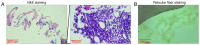 Figure 2. Histological examination of bone marrow via H&E and reticulin fiber staining. (A) H&E staining of bone marrow. Magnification, ×40 or ×400; scale bars, 500 or 50 µm. (B) Reticulin fiber stain...