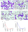 Figure 1. Morphological analysis and blast proportion changes in bone marrow cells before and after treatment. (A) Morphological examination of bone marrow cells conducted before and after treatment. ...