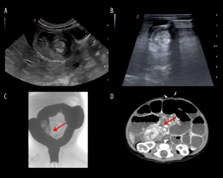 Figure 1.