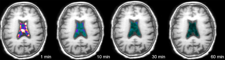 FIG. 1.