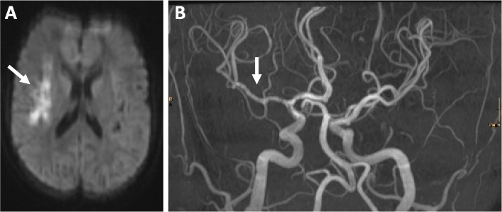 Fig. 2