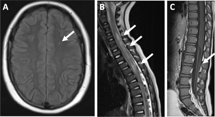 Fig. 1