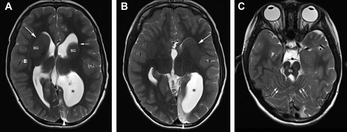 Fig. 1