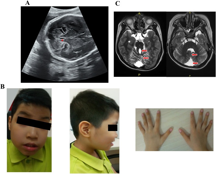 Fig. 1