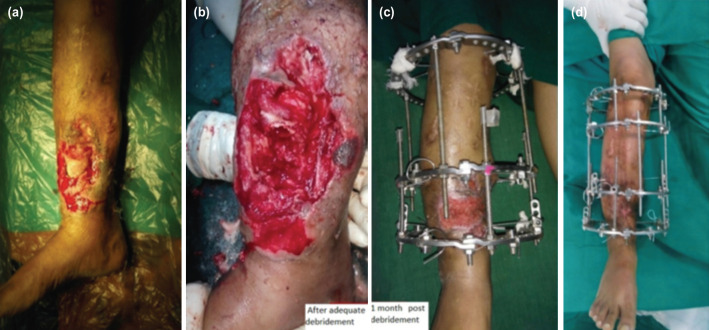 Fig. 2: