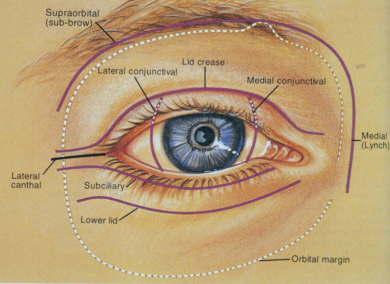 Fig. 23