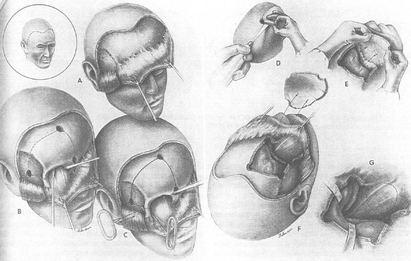 Fig. 19