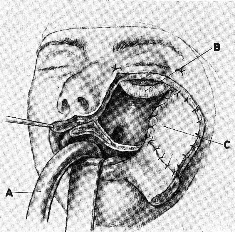 Fig. 12