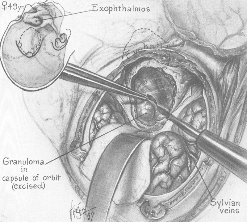 Fig. 11