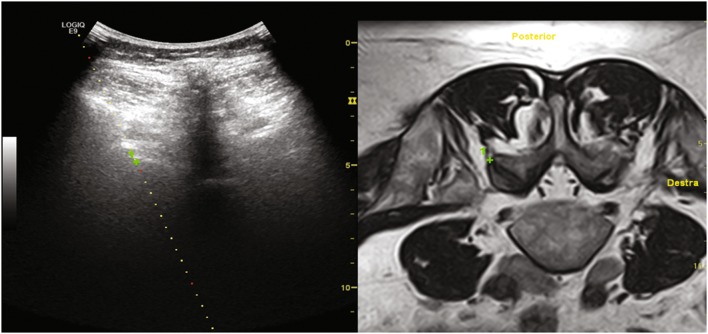 Fig. 4