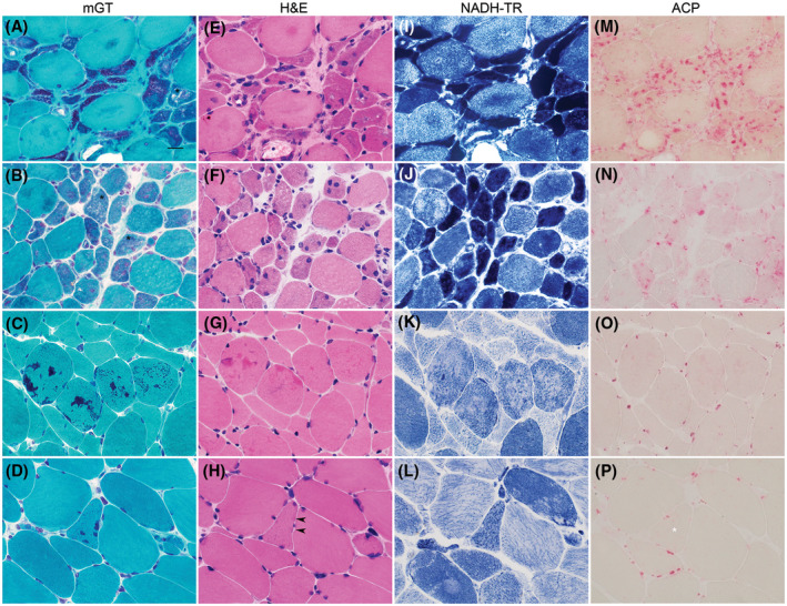 FIGURE 1