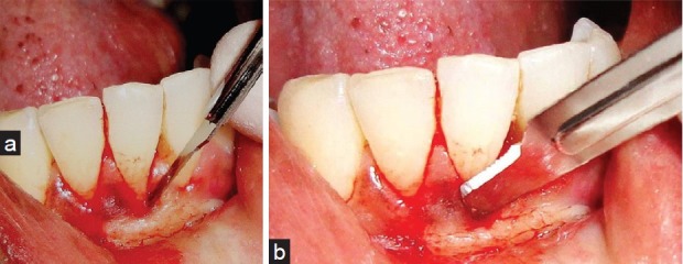 Figure 16